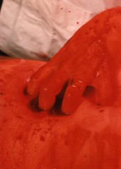 CHIRURGIE 16 A MAIN NUE DE RANKY.jpg